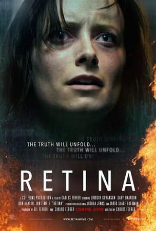 Сетчатка онлайн